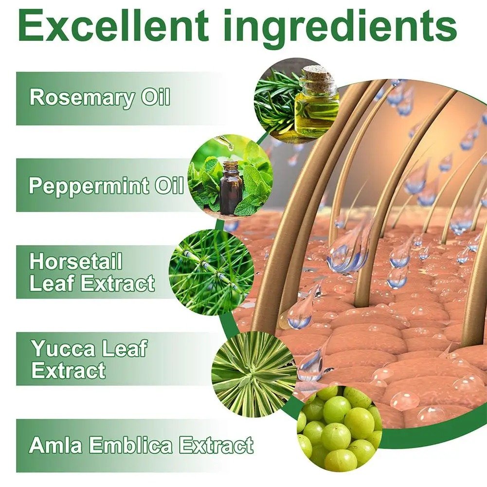 ماء إكليل الجبل لنمو الشعر - الصورة 5