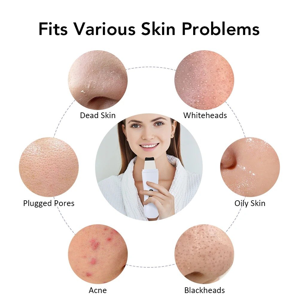 جهاز تنظيف المسام - الصورة 3